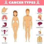 ¿Qué es el CÁNCER? Tipos de cáncer y cómo aparecen